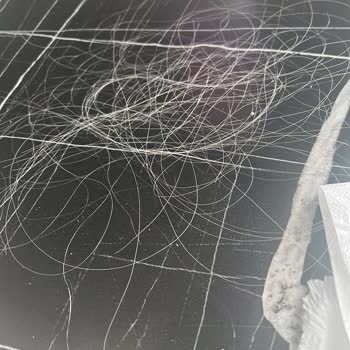 Samet Saç Tasarım (Ankara) Taktığı Saçlar 4 Günde Döküldü