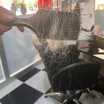 Samet Saç Tasarım (Ankara) Taktığı Saçlar 4 Günde Döküldü