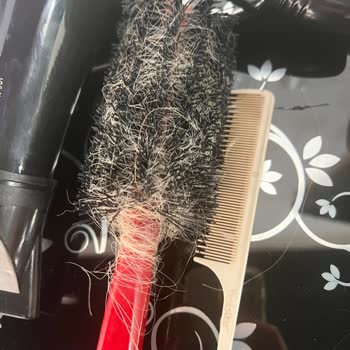 Samet Saç Tasarım (Ankara) Taktığı Saçlar 4 Günde Döküldü