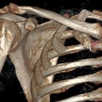 Citys AVM Taş Döşemesinin İnsanı Ameliyatlık Etmesi