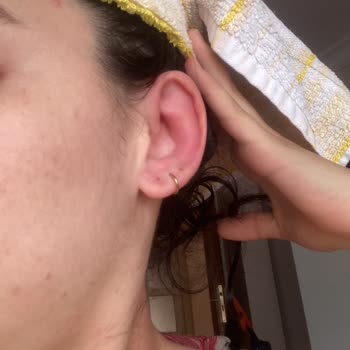 Velavit Alerji Ve Kaşıntı Şikayeti