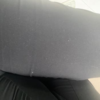 Zara Pantolonum Eskidi Resmen