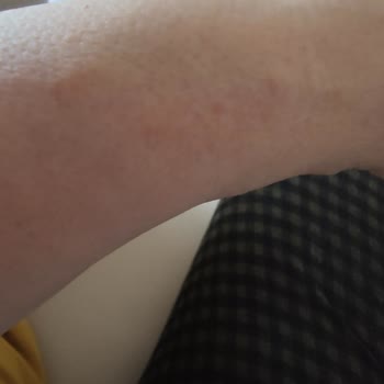 Michael Kors Alerji Yapan Ve Kordonu Kısa Gelen Saat