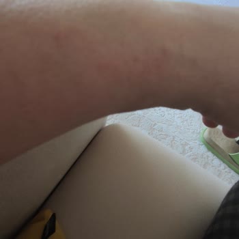 Michael Kors Alerji Yapan Ve Kordonu Kısa Gelen Saat