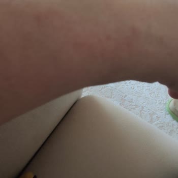 Michael Kors Alerji Yapan Ve Kordonu Kısa Gelen Saat