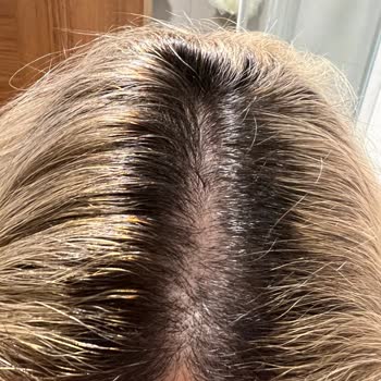 Evren Tekin Kuaför Saçım Turuncu Oldu ve Dönüş Sağlanmıyor