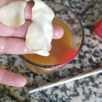 Mis Yabancı Madde Çıkması