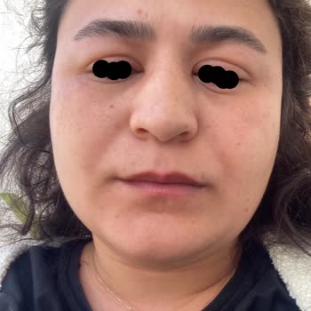 Abdi İbrahim Apranax Plus Yan Etkisi