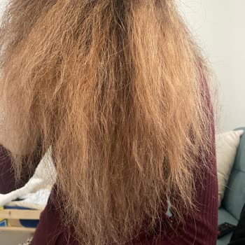 Nodda Güzellik Merkezi Saçım Yandı Ve Çok Kötü Bir Renk Yaptı