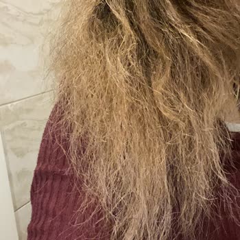 Nodda Güzellik Merkezi Saçım Yandı Ve Çok Kötü Bir Renk Yaptı