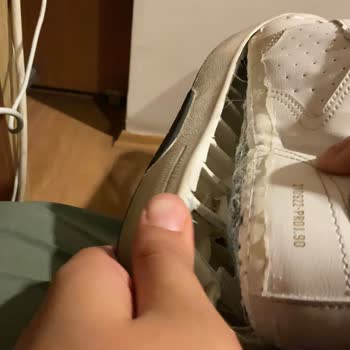 The Soles of My Bershka Shoes Came Out, Couldn't Walk With Them