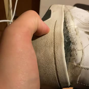The Soles of My Bershka Shoes Came Out, Couldn't Walk With Them