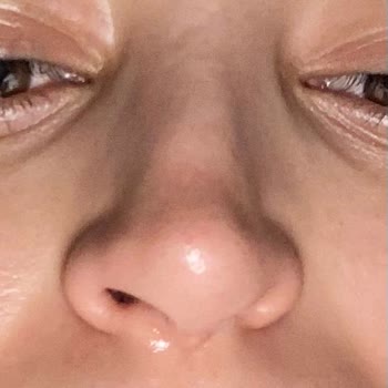 Avrupa Hospital (Adana) Avrupa Hospital Hastanesi