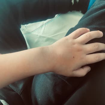 Özel Eryaman Hastanesi Çocuk Hemşiresi Yok!