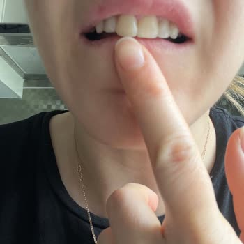 Maydent Ağız Ve Diş Sağlığı Maydent Diş Kliniği'ndeki Tel Tedavim Sonrası Yaşadığım Mağduriyet