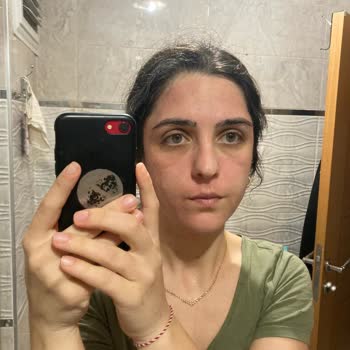 Gratis Otacı Jel Nemlendirici-Yağsız Matlaştıran Cilt Yanığı Sebebi