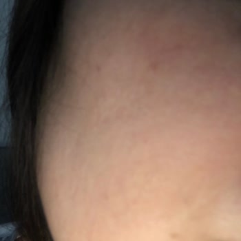 Loreal Paris Yüz Temizleme Jeli