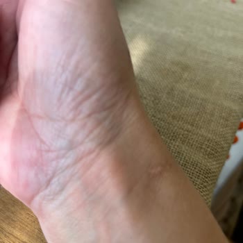 Maybelline Lifter Gloss Dudak Parlatıcısı Alerji Yaptı