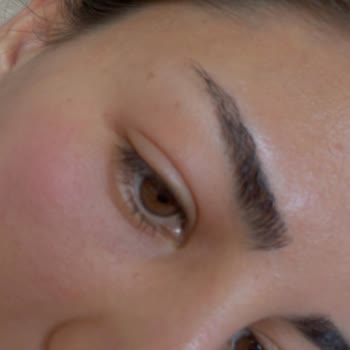 The Purest Solutions The Purest Göz Serumu Şikayeti