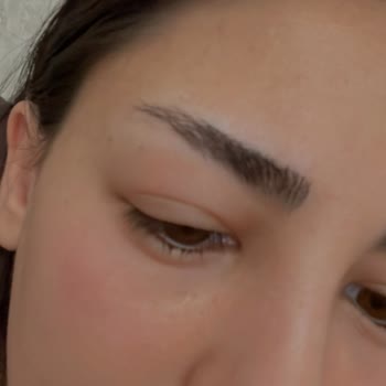 The Purest Solutions The Purest Göz Serumu Şikayeti