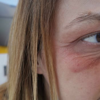 Loreal Revitalift Filler Aydınlatıcı Göz Serumu