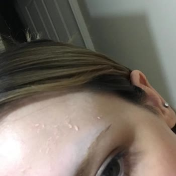 Sinoz Pembe Güneş Kremi Bozuk Çıktı