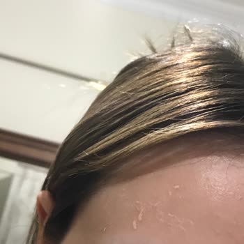 Sinoz Pembe Güneş Kremi Bozuk Çıktı