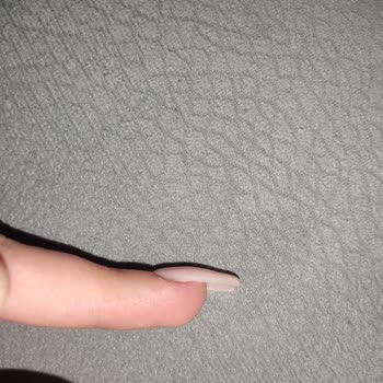 Aymira Koçaklı Yaşam Merkezi Aymira Koçak Tırnak Hüsranı