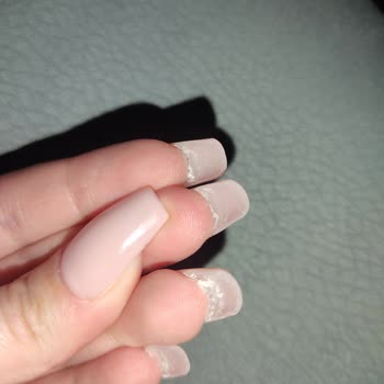 Aymira Koçaklı Yaşam Merkezi Aymira Koçak Tırnak Hüsranı