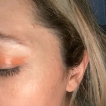 The Purest Solutions The Purest Solution Sivilce Yaptı