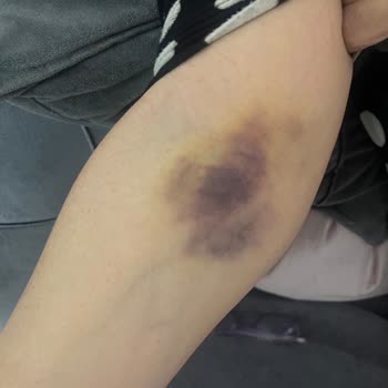 Liv Hospital Vadi Hemşirelerinin Vasatlığı