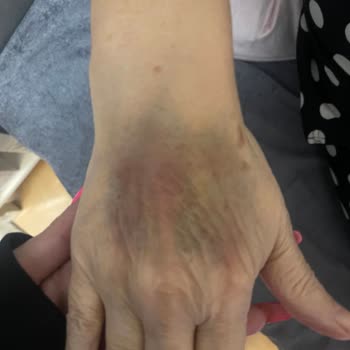 Liv Hospital Vadi Hemşirelerinin Vasatlığı