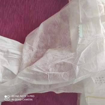 Jender Hatalı Bezin Çıkması