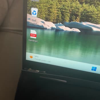 Lenovo Bilgisayar Laptopumun Tablet Yaparken Mekanizmasının Kırılması