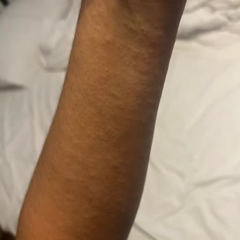 Atacity Hotel Zen SPA Memnuniyetsizlik Bildirimi