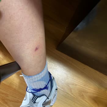 Lusy Studio (Antalya) Köpekleri Saldırdı