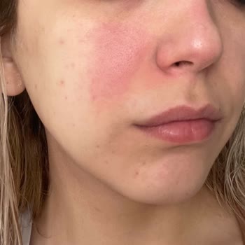 Yves Rocher Yüz Yıkama Jeli