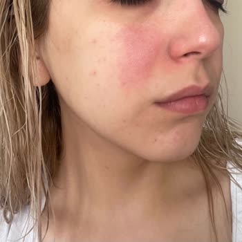 Yves Rocher Yüz Yıkama Jeli