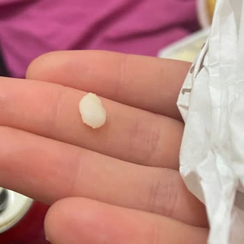 Burger King Hamburgerden Kıkırdak Çıktı