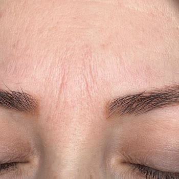 Emsal Doğan Güzellik ve Tırnak Merkezi Kaş Sildirme İşlemi Memnuniyetsizliği