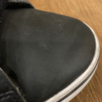 Deichmann Adidas Ayakkabımda Üretim Hatası Var
