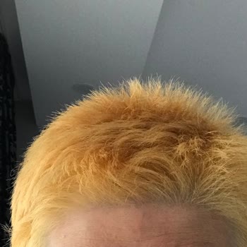 Palette Yüzünden Hem Rezil Oldum Hem Derim Yandı