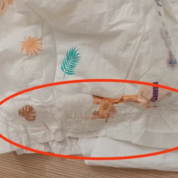 Baby & Me Ebebek Bebek Bezi İçerisinde Silikon Benzeri Bir Madde Buldum