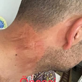 Özel Ekol International Tıp Merkezi Fonksiyonel Lazer Estetik Amaçlı