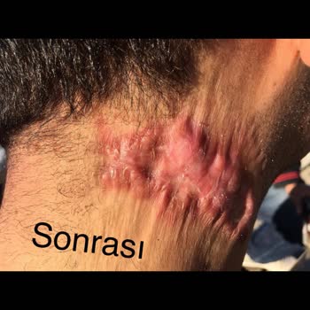 Özel Ekol International Tıp Merkezi Fonksiyonel Lazer Estetik Amaçlı