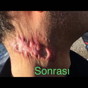 Özel Ekol International Tıp Merkezi Fonksiyonel Lazer Estetik Amaçlı