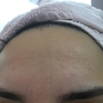 Cerave Temizleyici Ve Kremi Yüzümü Mahvetti