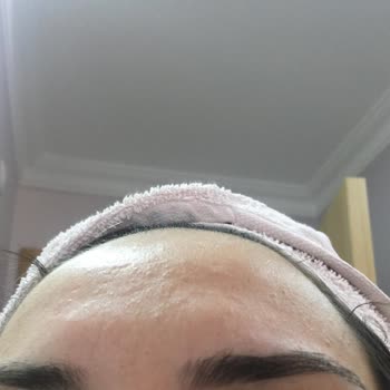 Cerave Temizleyici Ve Kremi Yüzümü Mahvetti