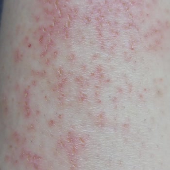 Şok Marketler'den Alınan Ten  Tüy Dökücü Krem Yaktı!