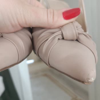 Meral Özgenç Birkaç Saat Giyilen Ayakkabının Derilerinin Soyulması